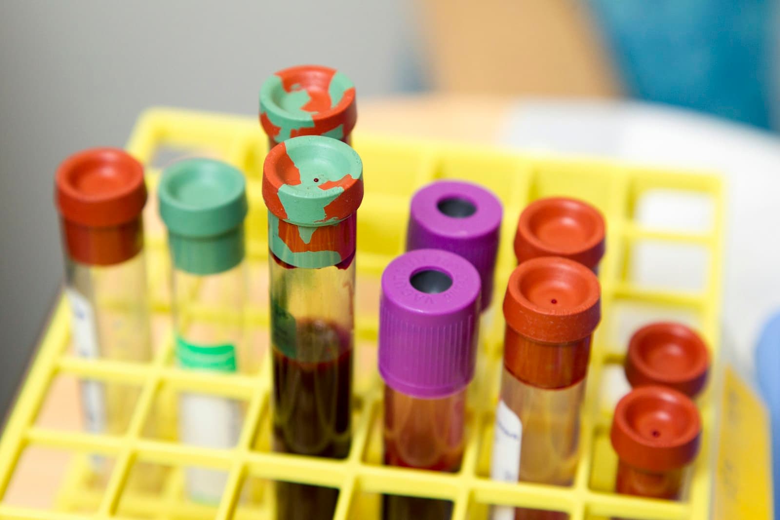 Blood sample tubes in a laboratory rack