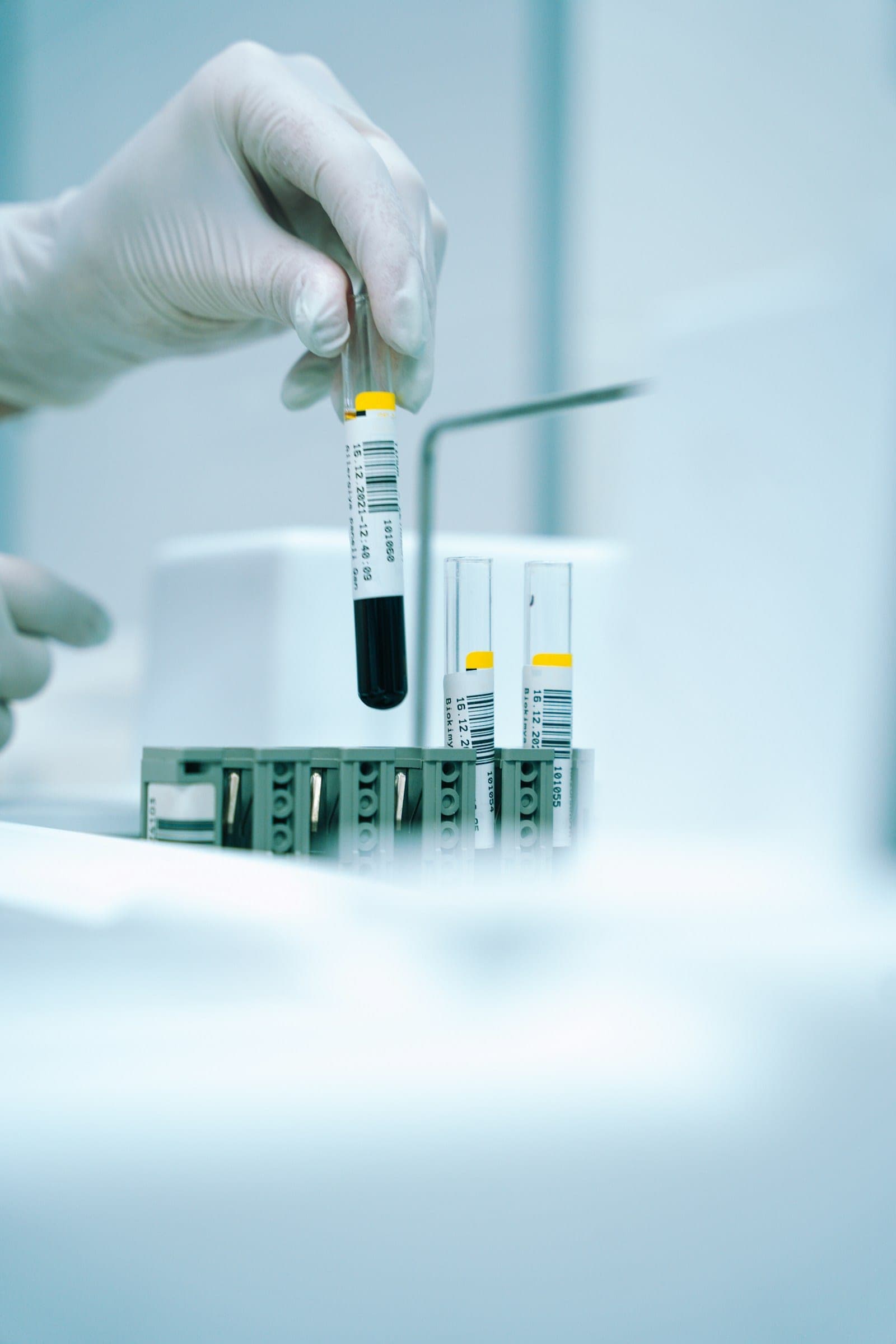 A gloved hand loading a blood sample tube into a laboratory analyser